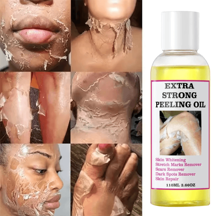 Extra Strong Peeling Oil
